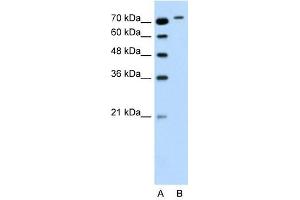 RHOBTB1 antibody used at 0. (RHOBTB1 antibody  (Middle Region))