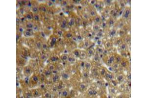 Used in DAB staining on fromalin fixed paraffin-embedded liver tissue (FSTL1 antibody  (AA 20-306))