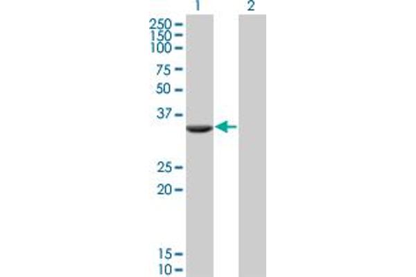 AKTIP 抗体  (AA 1-292)