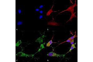 Immunocytochemistry/Immunofluorescence analysis using Mouse Anti-TARP Gamma2/4/8 (Stargazin) Monoclonal Antibody, Clone S245-36 (ABIN2483283). (Stargazin antibody  (AA 203-323) (APC))