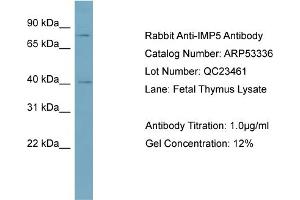 WB Suggested Anti-IMP5  Antibody Titration: 0. (SPPL2C antibody  (Middle Region))