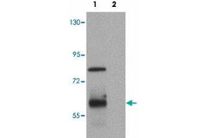 Western blot analysis of KAL1 in MCF-7 cell lysate with KAL1 polyclonal antibody  at 1 ug/mL.