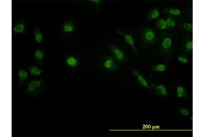 Immunofluorescence of monoclonal antibody to LDB2 on HeLa cell. (LIM Domain Binding 2 Protein antibody  (AA 1-373))