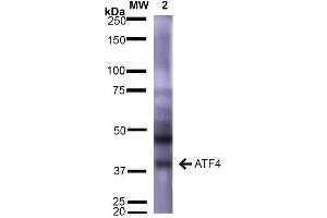 Western Blot analysis of Rat Brain showing detection of ~39 kDa (isoform 2) ATF4 protein using Mouse Anti-ATF4 Monoclonal Antibody, Clone S360A-24 . (ATF4 antibody  (AA 25-327) (Atto 488))