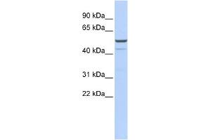 WB Suggested Anti-KCNK12 Antibody Titration:  0. (KCNK12 antibody  (Middle Region))