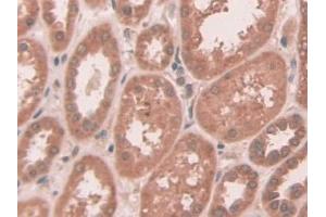 DAB staining on IHC-P; Samples: Human Kidney Tissue (ABCC10 antibody  (AA 1246-1492))