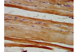 IHC image of ABIN7152365 diluted at 1:600 and staining in paraffin-embedded human skeletal muscle tissue performed on a Leica BondTM system.