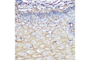Immunohistochemistry of paraffin-embedded human esophageal using Annexin  Rabbit mAb (ABIN7265619) at dilution of 1:100 (40x lens). (Annexin A2 antibody)