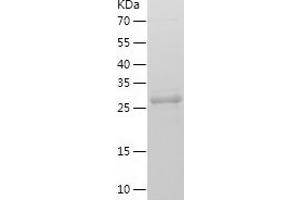 SCGN Protein (AA 2-276) (His tag)