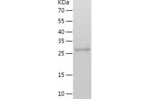 SCGN Protein (AA 2-276) (His tag)