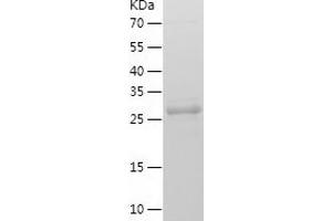 Western Blotting (WB) image for Secretagogin, EF-Hand Calcium Binding Protein (SCGN) (AA 2-276) protein (His tag) (ABIN7284663) (SCGN Protein (AA 2-276) (His tag))