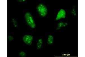 Image no. 2 for anti-Glial Cells Missing Homolog 1 (GCM1) (AA 108-166) antibody (ABIN599044) (GCM1 antibody  (AA 108-166))