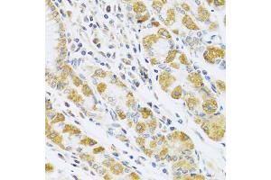 Immunohistochemistry of paraffin-embedded human stomach using PSG1 antibody (ABIN5973801) at dilution of 1/100 (40x lens). (PSG1 antibody)