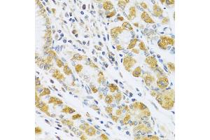 Immunohistochemistry of paraffin-embedded human stomach using PSG1 antibody (ABIN5973801) at dilution of 1/100 (40x lens).