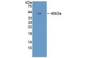Detection of Recombinant NCOA3, Human using Polyclonal Antibody to Nuclear Receptor Coactivator 3 (NCOA3) (NCOA3 antibody  (AA 1023-1304))