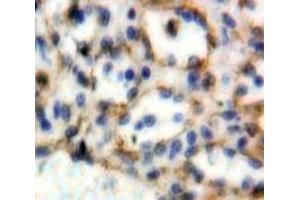 IHC-P analysis of Spleen tissue, with DAB staining. (CD72 antibody  (AA 169-359))