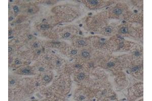 Detection of BMF in Human Liver Tissue using Polyclonal Antibody to Bcl2 Modifying Factor (BMF) (BMF antibody  (AA 1-181))