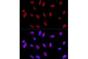 Immunofluorescence analysis of HeLa using AhR Rabbit mAb (ABIN7265679) at dilution of 1:100 (40x lens). (Aryl Hydrocarbon Receptor antibody)