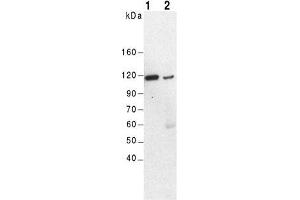 Western Blot of mouse kidney (lane 1) and brain (lane 2) using anti-α-Actinin-4, pAb (IG-701) . (alpha Actinin 4 antibody  (C-Term, N-Term))
