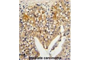 Immunohistochemistry (IHC) image for anti-Lumican (LUM) antibody (ABIN3003324) (LUM antibody)