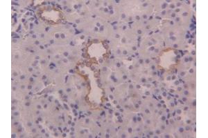 DAB staining on IHC-P; Samples: Rat Kidney Tissue (KRT6A antibody  (AA 323-461))