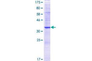 NAT8B Protein (AA 1-143) (GST tag)