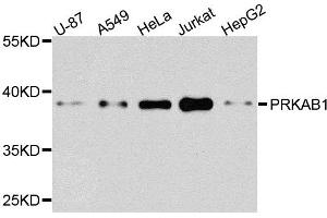 Western blot analysis of extracts of various cells, using PRKAB1 antibody. (PRKAB1 antibody)