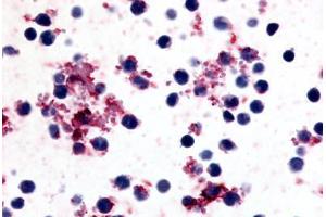 Anti-Prostaglandin I2 Receptor antibody  ABIN1049252 IHC staining of human platelets. (Prostacyclin Receptor antibody  (N-Term))