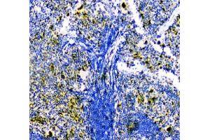IHC analysis of ZEB2 using anti-ZEB2 antibody (ABIN3042325). (ZEB2 antibody  (AA 1-200))
