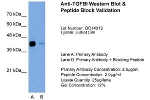 Host: Rabbit Target Name: TGFBI Sample Type: Jurkat Lane A: Primary Antibody Lane B: Primary Antibody + Blocking Peptide Primary Antibody Concentration: 2.