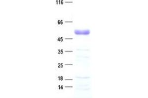Validation with Western Blot (PBX4 Protein (His tag))