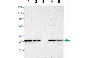 Western Blot analysis of Lane 1: RT-4, Lane 2: U-251MG sp, Lane 3: human plasma (IgG/HSA depleted), Lane 4: human liver and Lane 5: human tonsil lysates with CLEC4E polyclonal antibody . (CLEC4E antibody)