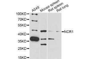 Western blot analysis of extracts of various cell lines, using NCR1 antibody (ABIN6291526) at 1:3000 dilution.