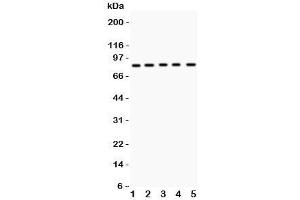 Western blot testing of MCAK antibody and Lane 1:  mouse testis;  2: human HeLa;  3: (h) MM231;  4: (h) MM453;  5: (h) SKOV lysate. (KIF2C antibody  (AA 531-725))