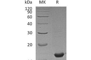 Western Blotting (WB) image for Peptidylprolyl Isomerase A (Cyclophilin A) (PPIA) protein (ABIN7320728) (PPIA Protein)