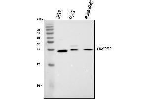 Western blot analysis of HMGB2 using anti-HMGB2 antibody (ABIN4886620). (HMGB2 antibody  (N-Term))