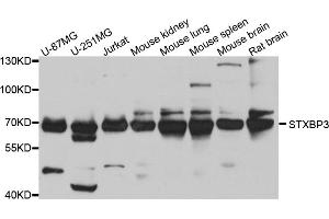 Western blot analysis of extracts of various cell lines, using STXBP3 antibody (ABIN5974503) at 1/1000 dilution. (STXBP3 antibody)