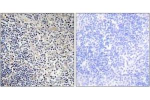 Immunohistochemistry analysis of paraffin-embedded human thymus gland tissue, using TPIP1 Antibody. (TP53AIP1 antibody  (AA 75-124))