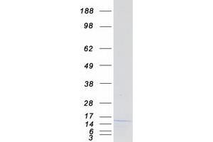 Western Blotting (WB) image for Nescient Helix Loop Helix 1 (NHLH1) protein (Myc-DYKDDDDK Tag) (ABIN2722616)