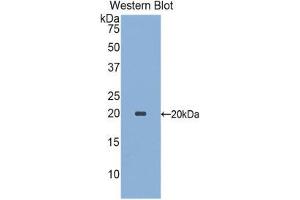 Western Blotting (WB) image for anti-Sialic Acid Binding Ig-Like Lectin 9 (SIGLEC9) (AA 23-142) antibody (ABIN1860557) (SIGLEC9 antibody  (AA 23-142))
