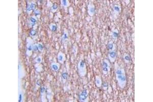 IHC-P analysis of Human Tissue, with DAB staining. (JAG1 antibody  (AA 470-834))