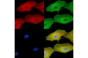 ABIN7096273 and ABIN7100335 staining  cells by IF/ICC. (VWA5B2 antibody)
