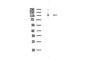 anti-Actinin, alpha 1/2/3/4 (ACTN1/ACTN2/ACTN3/ACTN4) (pSer159) antibody