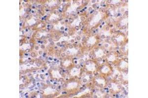 Immunohistochemistry (Paraffin-embedded Sections) (IHC (p)) image for anti-Interferon Regulatory Factor 3 (IRF3) (C-Term) antibody (ABIN500054)