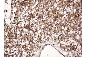 Image no. 1 for anti-B and T Lymphocyte Associated (BTLA) antibody (ABIN1496983) (BTLA antibody)