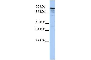 WB Suggested Anti-MCTP1 Antibody Titration:  1 ug/ml  Positive Control:  Hela cell lysate (MCTP1 antibody  (Middle Region))