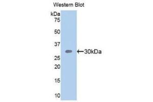 Detection of Recombinant SEMA5B, Human using Polyclonal Antibody to Semaphorin 5B (SEMA5B) (SEMA5B antibody  (AA 350-602))