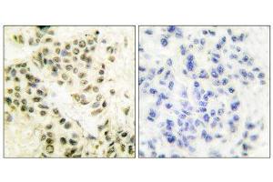 Immunohistochemistry (IHC) image for anti-Protein Kinase, DNA-Activated, Catalytic Polypeptide (PRKDC) (C-Term) antibody (ABIN1848510) (PRKDC antibody  (C-Term))