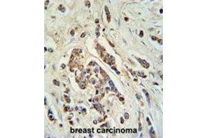 Immunohistochemistry (IHC) image for anti-ATP-Binding Cassette, Sub-Family C (CFTR/MRP), Member 11 (ABCC11) antibody (ABIN3002133) (ABCC11 antibody)