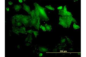 Immunofluorescence of monoclonal antibody to SDCBP on HepG2 cell. (SDCBP antibody  (AA 1-100))